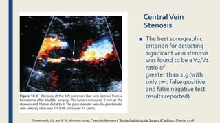 CentralVein
Stenosis
■ The best sonographic
criterion for detecting
significant vein stenosis
was found to be aV2/V1
ratio of
greater than 2.5 (with
only two false-positive
and false negative test
results reported)
Cronenwett, J. L. and K.W. Johnston (2014).””vascular laboratory” Rutherford'sVascular Surgery 8th edition , Chapter 17-18
 