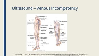 Ultrasound –Venous Incompetency
Cronenwett, J. L. and K.W. Johnston (2014).””vascular laboratory” Rutherford'sVascular Surgery 8th edition , Chapter 17-18
 