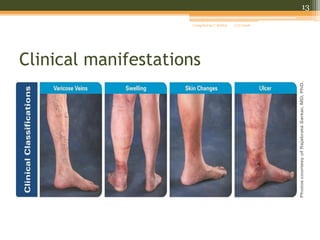 Venous stasis ulcers | PDF