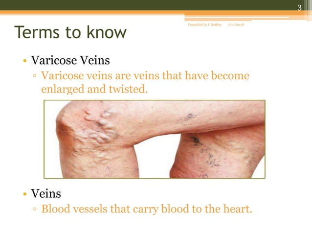 Venous stasis ulcers | PPT
