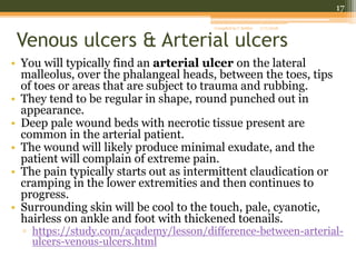Venous stasis ulcers | PPT