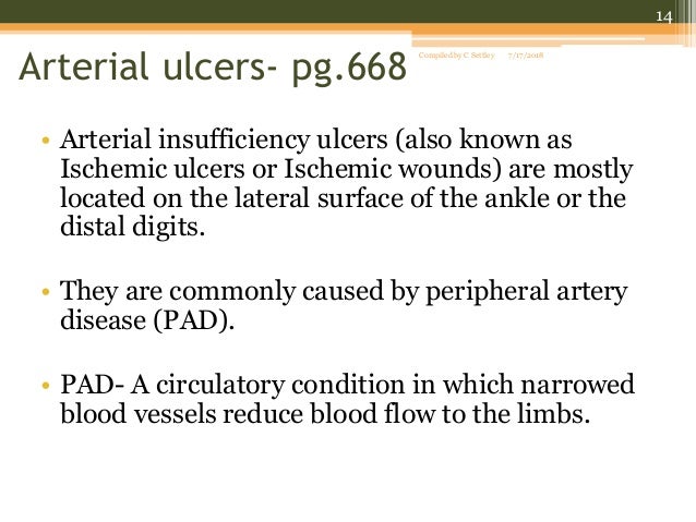 Venous stasis ulcers