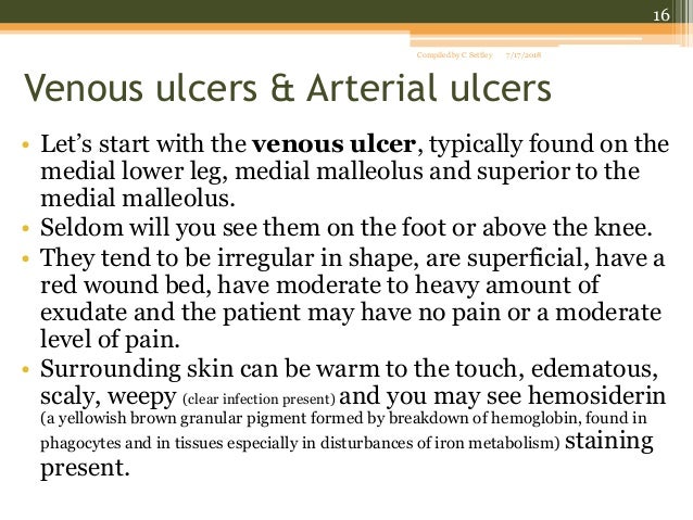 Venous stasis ulcers