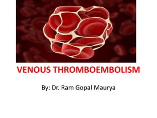 VENOUS THROMBOEMBOLISM
By: Dr. Ram Gopal Maurya
 