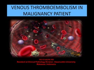 VENOUS THROMBOEMBOLISM IN
MALIGNANCY PATIENT

MUSTAKIM.MD
Resident at Clinical Pathology Division Hasanuddin University
Makassar, Indonesia

 