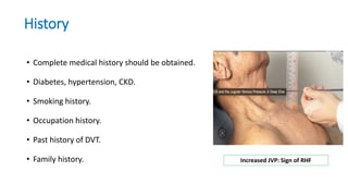 History
• Complete medical history should be obtained.
• Diabetes, hypertension, CKD.
• Smoking history.
• Occupation history.
• Past history of DVT.
• Family history. Increased JVP: Sign of RHF
 