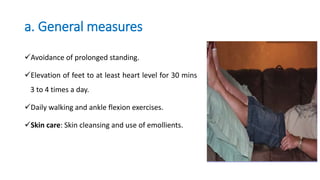 a. General measures
Avoidance of prolonged standing.
Elevation of feet to at least heart level for 30 mins
3 to 4 times a day.
Daily walking and ankle flexion exercises.
Skin care: Skin cleansing and use of emollients.
 