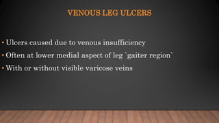 VENOUS LEG ULCERS
• Ulcers caused due to venous insufficiency
• Often at lower medial aspect of leg `gaiter region`
• With or without visible varicose veins
 