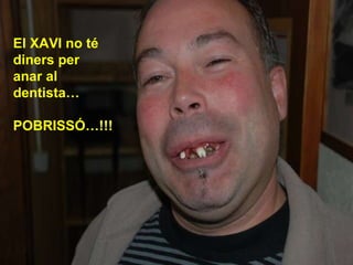 El XAVI no té diners per  anar al dentista… POBRISSÓ…!!! 