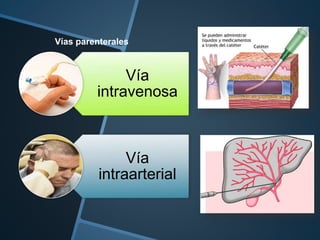 Vías parenterales
Vía
intravenosa
Vía
intraarterial
 