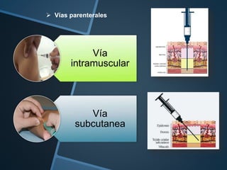 Vía
intramuscular
Vía
subcutanea
 Vías parenterales
 