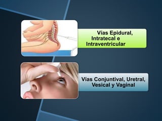 Vías Epidural,
Intratecal e
Intraventricular
•
•
Vías Conjuntival, Uretral,
Vesical y Vaginal
 
