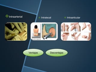 Intraarterial  Intratecal  Intraarticular
Ventajas Desventajas
 