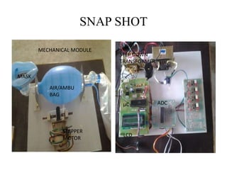 SNAP SHOT 
MECHANICAL MODULE 
MASK 
AIR/AMBU 
BAG 
STEPPER 
MOTOR 
ADC 
STEP DOWN 
TRANSFORMER 
μC 
LCD 
 