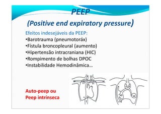 PEEP
(Positive end expiratory pressure)
Efeitos indesejáveis da PEEP:
•Barotrauma (pneumotoráx)
•Fístula broncopleural (aumento)
•Hipertensão intracraniana (HIC)
•Rompimento de bolhas DPOC•Rompimento de bolhas DPOC
•Instabilidade Hemodinâmica…
Auto-peep ou
Peep intrínseca
 