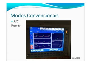 Modos Convencionais
A/C
Pressão
HC-UFTM
 