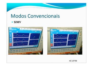 Modos Convencionais
SIMV
HC-UFTM
 