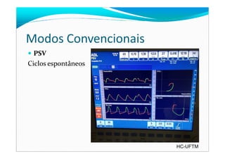 Modos Convencionais
PSV
Ciclos espontâneos
HC-UFTM
 