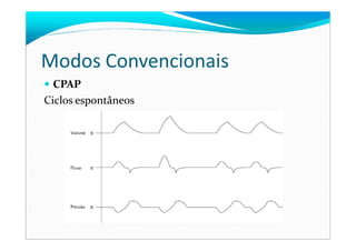 Modos Convencionais
CPAP
Ciclos espontâneos
 