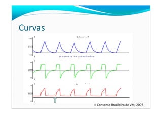 Curvas
III Consenso Brasileiro de VM, 2007
 
