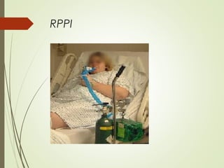 RPPI

 