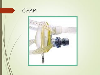 CPAP

 