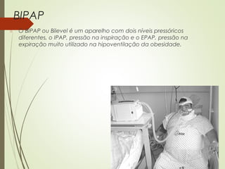 BIPAP


O BIPAP ou Bilevel é um aparelho com dois níveis pressóricos
diferentes, o IPAP, pressão na inspiração e o EPAP, pressão na
expiração muito utilizado na hipoventilação da obesidade.

 