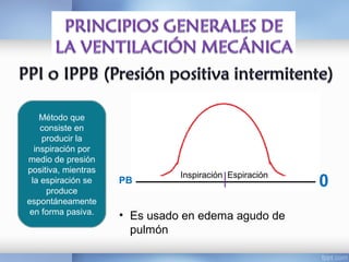 Método que
consiste en
producir la
inspiración por
medio de presión
positiva, mientras
la espiración se
produce
espontáneamente
en forma pasiva.
0PB
• Es usado en edema agudo de
pulmón
Inspiración Espiración
 