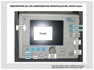 8
Fernando Gutiérrez Muñoz; Ventilación Mecánica;
Acta méd. peruana v.28 n.2 Lima abr./jun. 2011
 