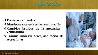 Dr. Marco Rivera Meza
Neumotórax
Presiones elevadas
Maniobras agresivas de reanimación
Cambios bruscos de la mecánica
ventilatoria
Traumatismo vía aérea, aspiración de
secreciones
 