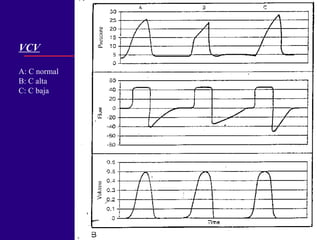 VCV
A: C normal
B: C alta
C: C baja
 