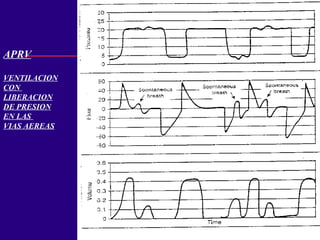 APRV
VENTILACION
CON
LIBERACION
DE PRESION
EN LAS
VIAS AEREAS
 