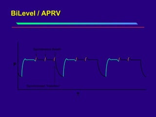 BiLevel / APRVBiLevel / APRV
Synchronized Transition
Spontaneous Breath
P
T
 