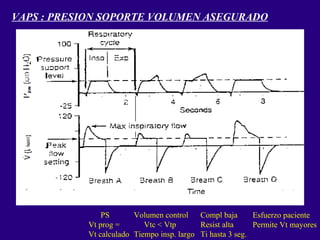 VAPS : PRESION SOPORTE VOLUMEN ASEGURADO
PS
Vt prog =
Vt calculado
Volumen control
Vtc < Vtp
Tiempo insp. largo
Compl baja
Resist alta
Ti hasta 3 seg.
Esfuerzo paciente
Permite Vt mayores
 