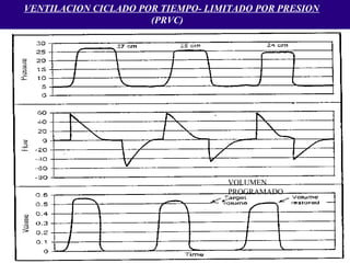 VENTILACION CICLADO POR TIEMPO- LIMITADO POR PRESION
(PRVC)
VOLUMEN
PROGRAMADO
 