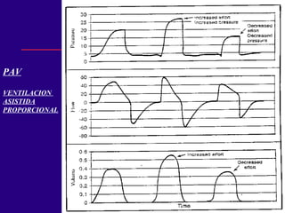 PAV
VENTILACION
ASISTIDA
PROPORCIONAL
 