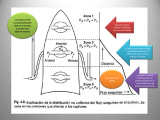 La relacion V/Q
es anormalmente
alta en el vertice             Espacio muerto
                             alveolar. Ventilada
  y mucho mas
                             pero no perfundida
 baja en la base




                                         En estas condiciones el flujo
                                           esta determinado por la
                                           diferencia entre presion
                                               arterial y alveolar




                                                      La presion arterial
                     Reclutamiento                    aumenta, pero la
                         capilar                    presion alveolar es la
                                                    misma-Diferencia de
                                                    presion arteriovenosa
 