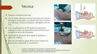 VENTILACION JET.pptx
