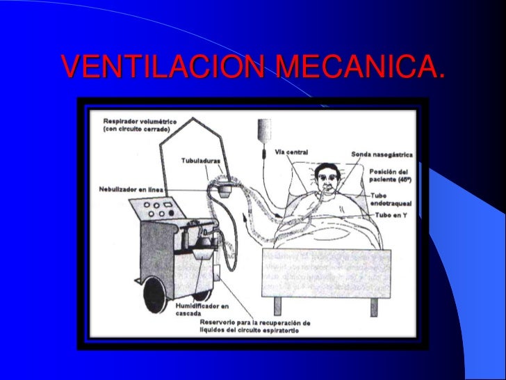 Ventilacion mecanica.