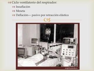 Ciclo ventilatorio del respirador:Insuflación MesetaDeflación--- pasivo por retracción elástica