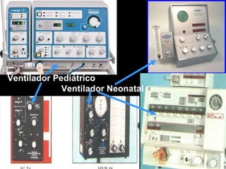 Ventilador Pediátrico Ventilador Neonatal 