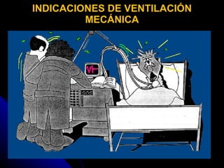INDICACIONES DE VENTILACIÓN MECÁNICA 