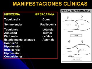 HIPOXEMIA HIPERCAPNIA Taquicardia Coma   Somnolencia   Papiledema Taquipnea Letargia Ansiedad Tremor Diaforesis cefalea Estado mental alterado Asterixis Confusión   Hipertensión Bradicardia Hipotensión Convulsiones. MANIFESTACIONES CLÍNICAS FATIGA DIAFRAGMÁTICA 