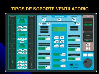TIPOS DE SOPORTE VENTILATORIO 