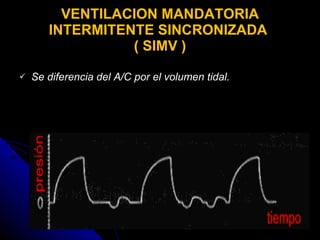 VENTILACION MANDATORIA INTERMITENTE SINCRONIZADA  ( SIMV ) Se diferencia del A/C por el volumen tidal. 