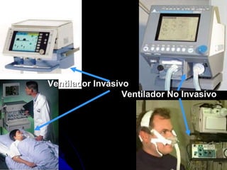 Ventilador Invasivo Ventilador No Invasivo 