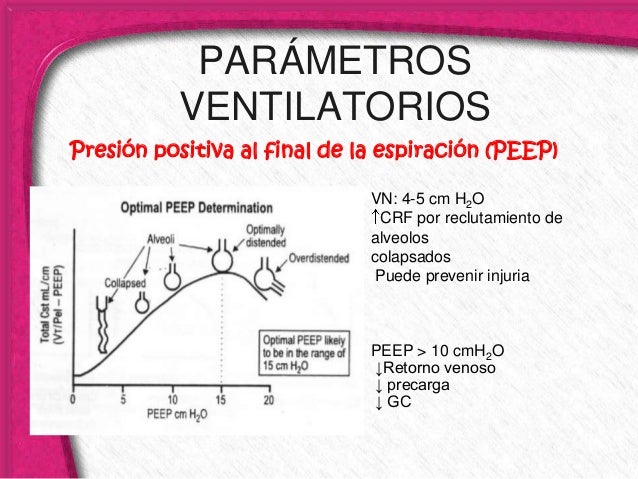 Ventilaci n Mec nica Pediatr a