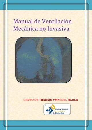 Manual de Ventilación
Mecánica no Invasiva




   GRUPO DE TRABAJO VMNI DEL HGUCR
 