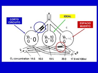 IDEAL ESPACIO MUERTO CORTO CIRCUITO 0 