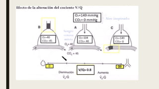 Ventilación perfusion pulmonar.   .pptx